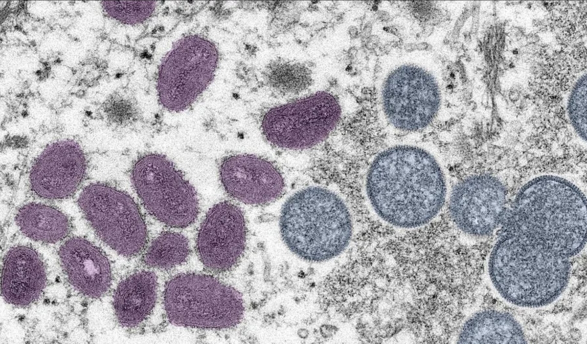 O variantă mai periculoasă a mpox descoperită într-o țară des frecventată de români / Câteva țări au luat deja măsuri