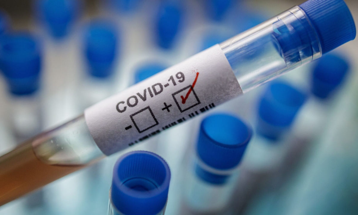 Oamenii de știință au aflat de ce s-a oprit brusc și neașteptat pandemia Covid-19