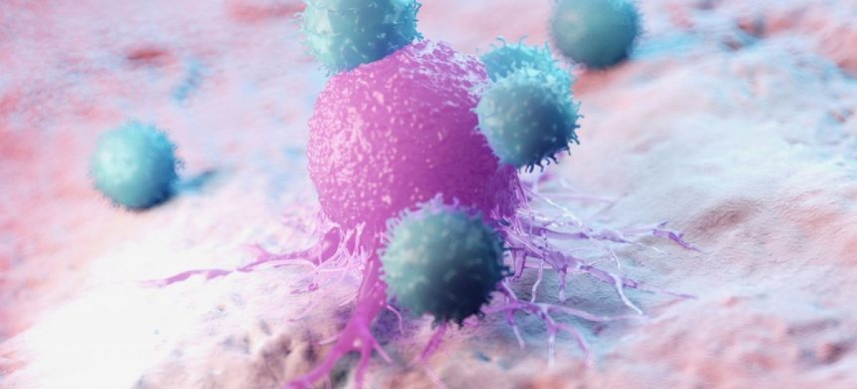 Anumite celule imunitare din intestin ar putea duce la dezvoltarea cancerului (studiu)