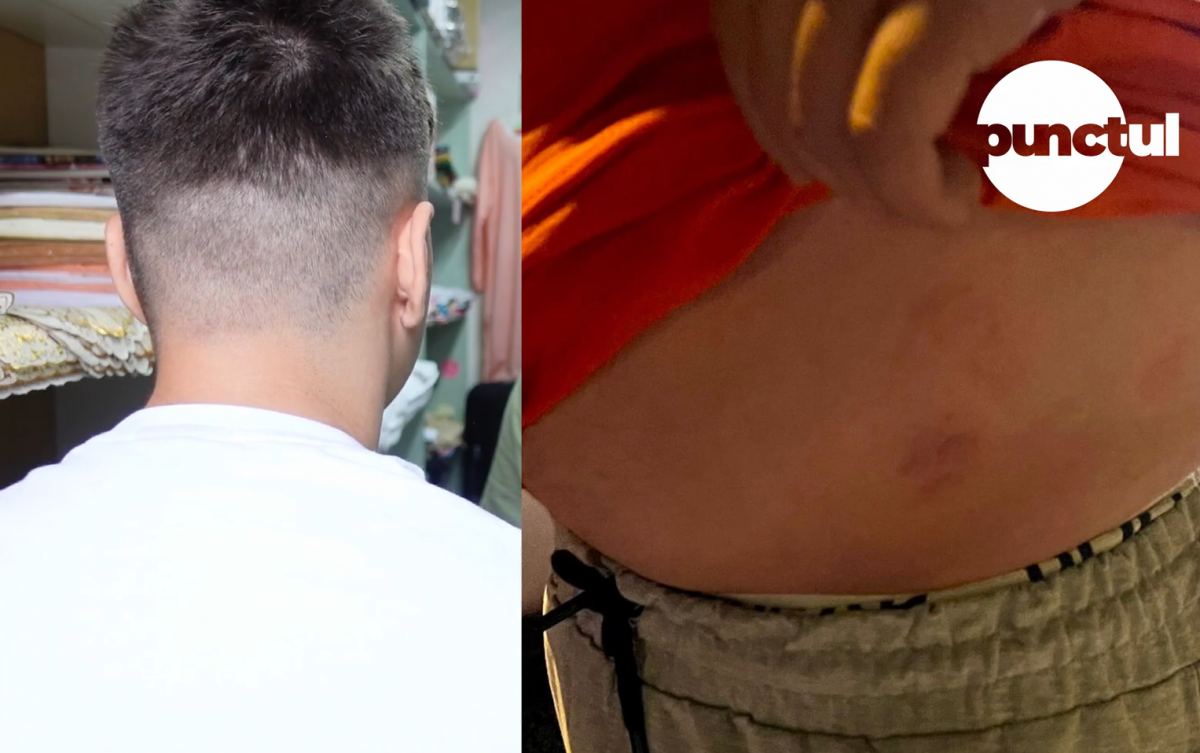 Polițiști sub lupa autorităților, după o agresiune violentă asupra unui tânăr de 17 ani
