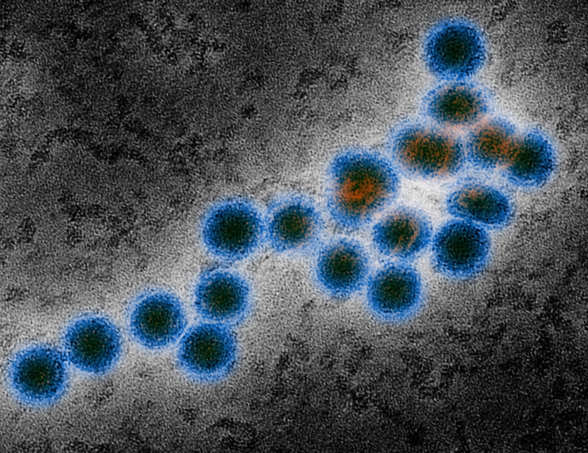 73 de cazuri de infecție cu virusul West Nile, înregistrate/ Nouă dintre pacienți au decedat