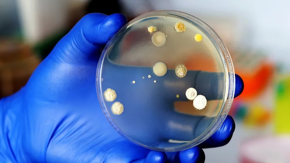 Bacteriile intestinale oferă noi date vitale: milioane de oameni vor scăpa de tratamente dureroase (studiu)