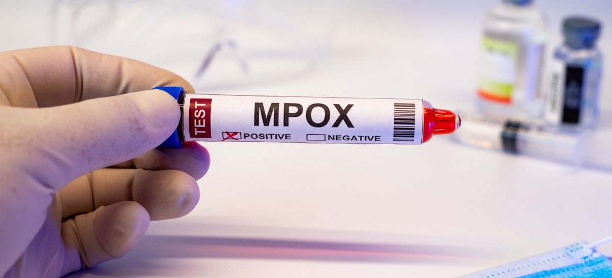 Mpox: Mai multe cazuri cu tulpina Clade 1b, detectate în Marea Britanie