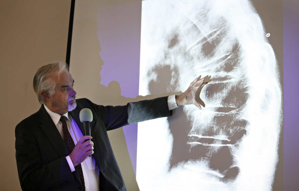 Proteina ce inhibă formarea oaselor ar putea deschide noi orizonturi în tratarea osteoporozei