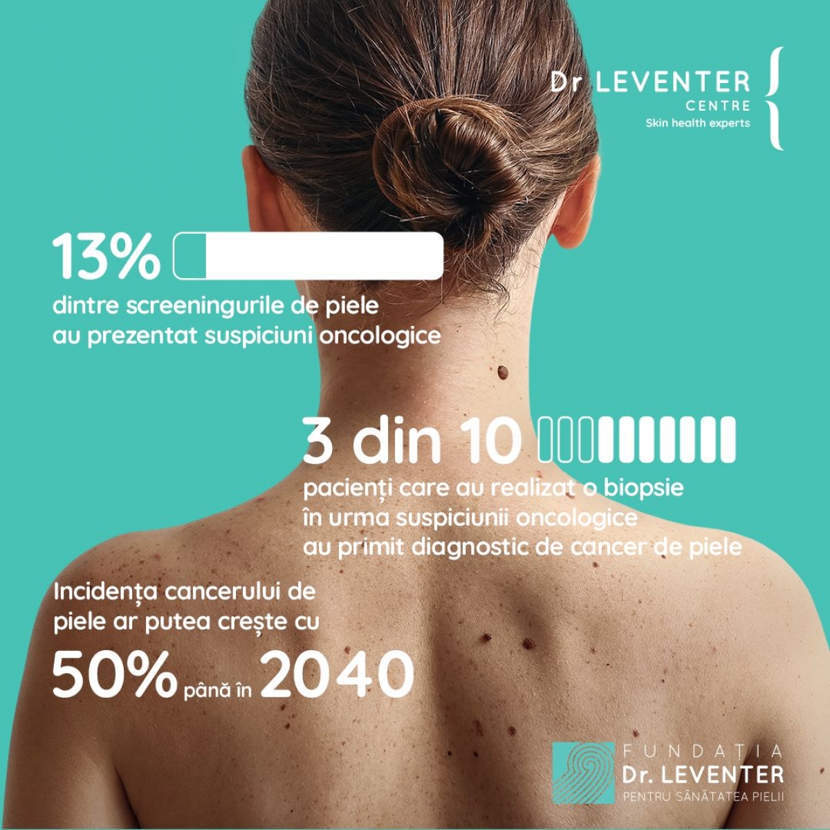Doar 2 din 10 persoane recunosc semnele melanomului. Dr. Mihaela Leventer: Ne vom confrunta tot mai des cu situații tragice