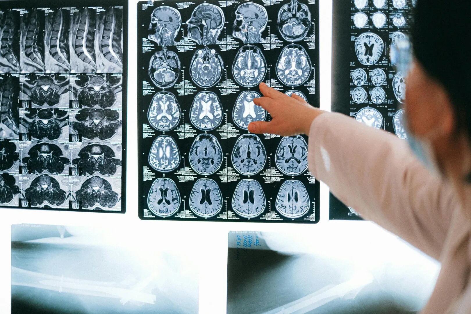 Gândurile ar putea fi traduse în cuvinte: Descoperirea Stanford care promite să redea vocea persoanelor paralizate