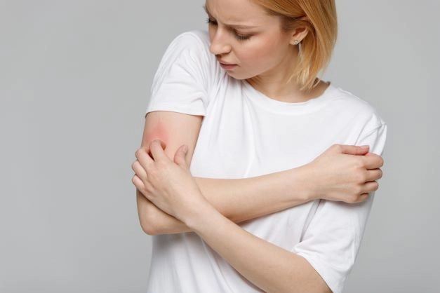 Inovaţii în diagnosticul şi tratamentul dermatitei atopice, prezentate de Ziua Mondială a Dermatitei Atopice
