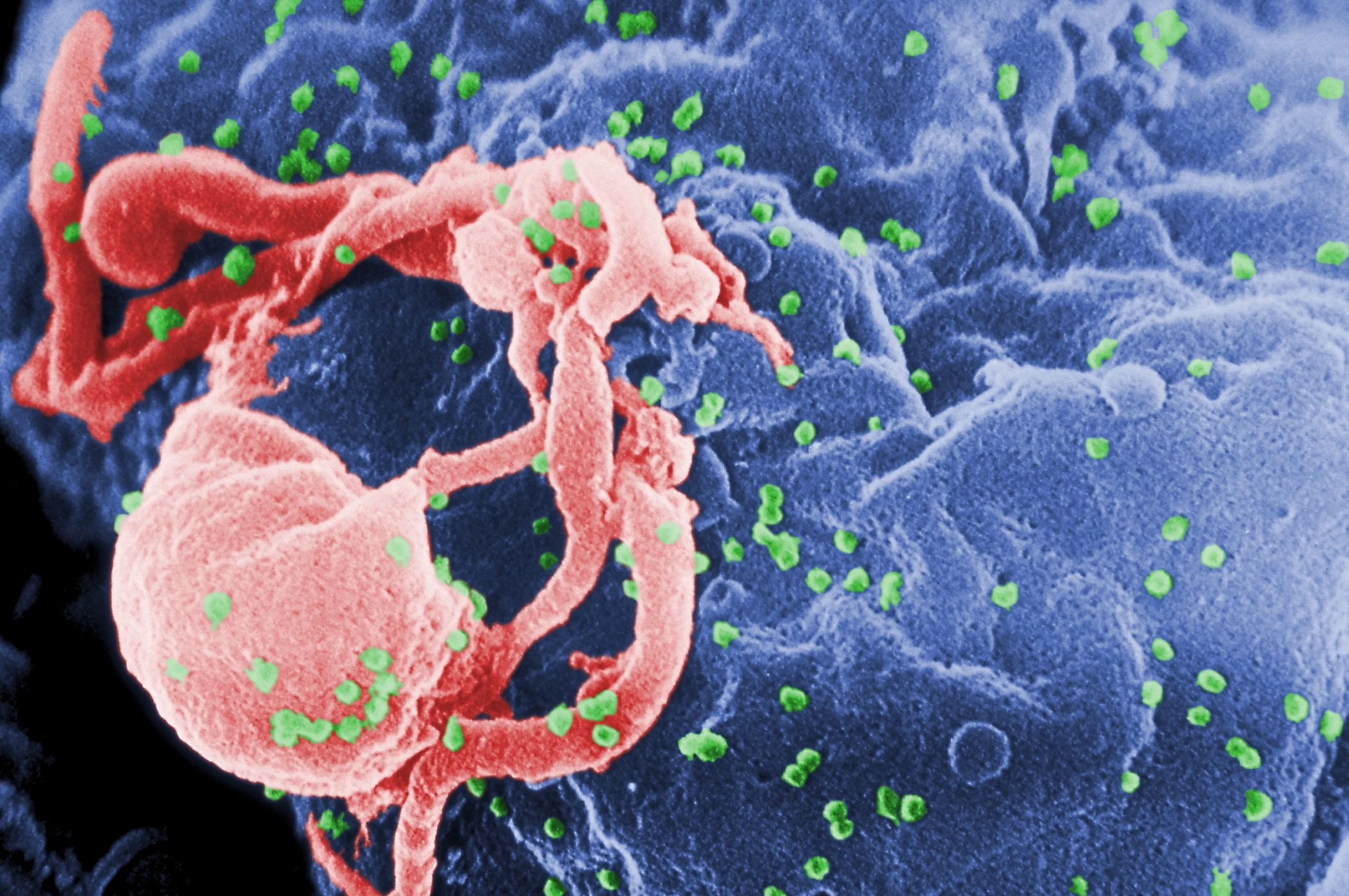 Avertisment la Conferința Europeană privind SIDA: Scăderea finanțării riscă să inverseze progresele în combaterea HIV