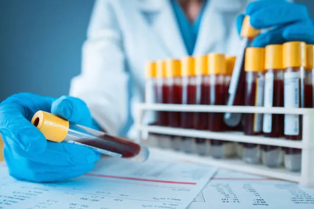 Creşterea nivelului de CO2 din atmosferă ar putea modifica chimia sângelui uman, sugerează un studiu