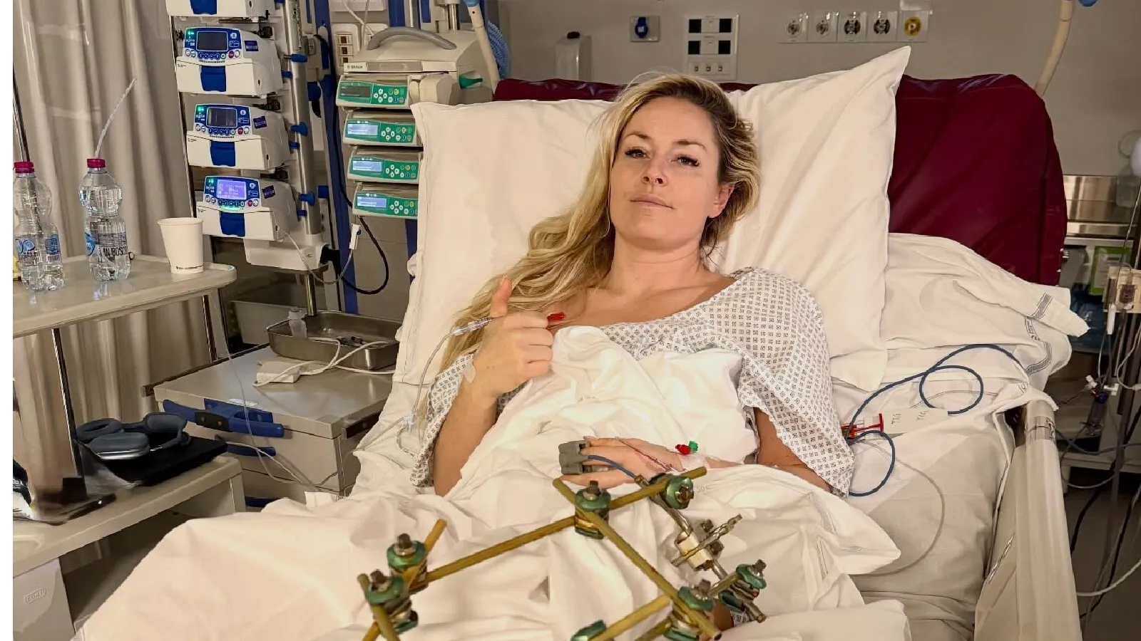 Lindsey Vonn, operată din nou la piciorul fracturat la Jocurile Olimpice