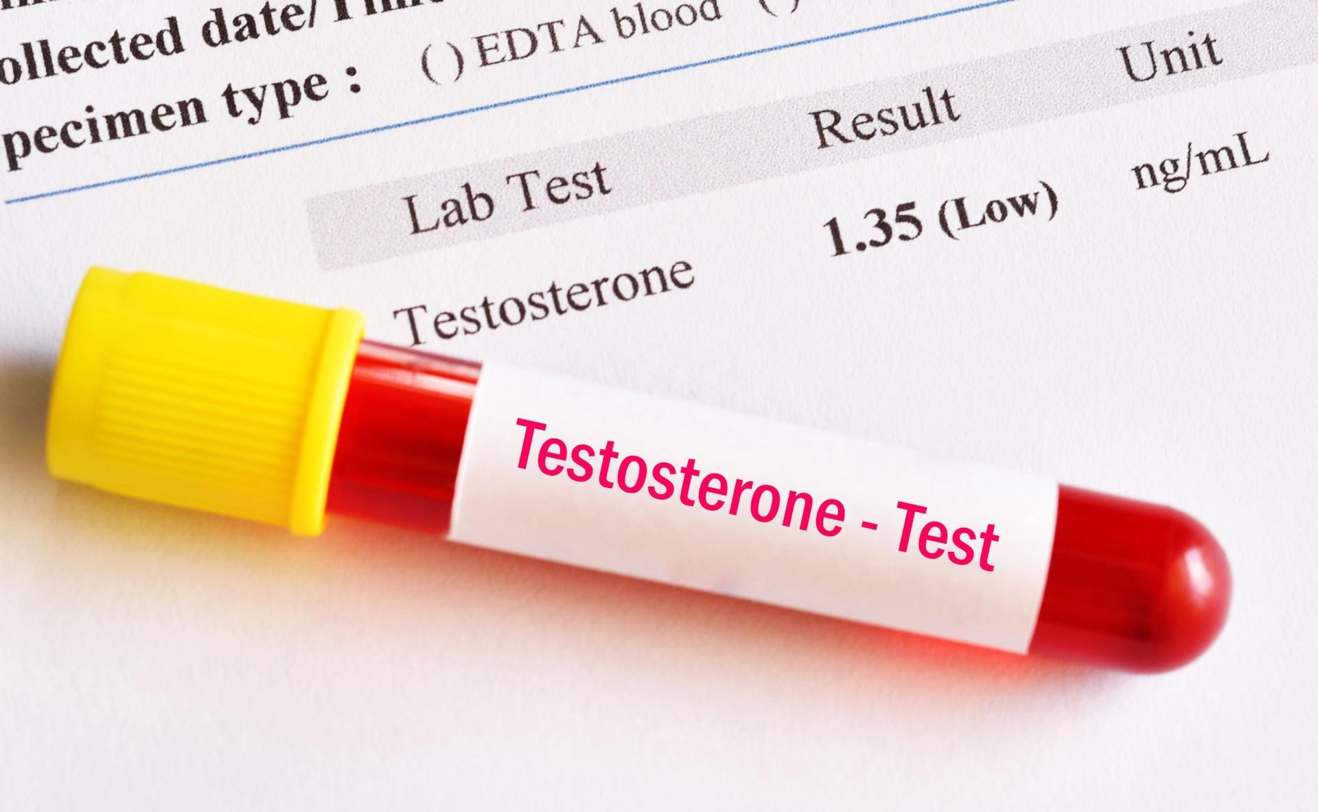 Când dorința scade, cresc rețetele pentru testosteron