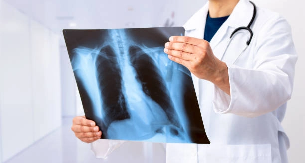Un nou centru modern pentru tuberculoză se deschide în București