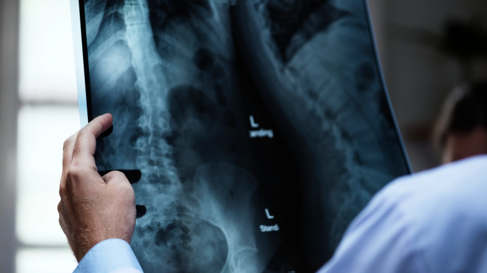 Medicul Mugur Grasu explică beneficiile radiologiei intervenționale în tratarea tumorilor hepatice