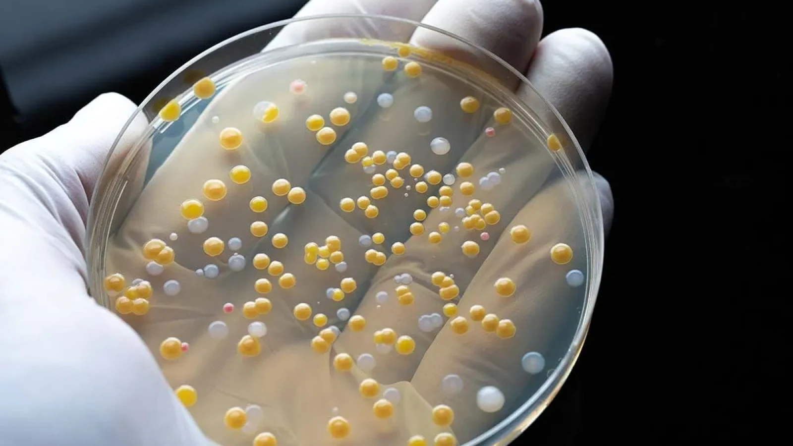 Dragostea chiar trece prin stomac! Cuplurile care locuiesc împreună împart până la 30% din bacteriile intestinale