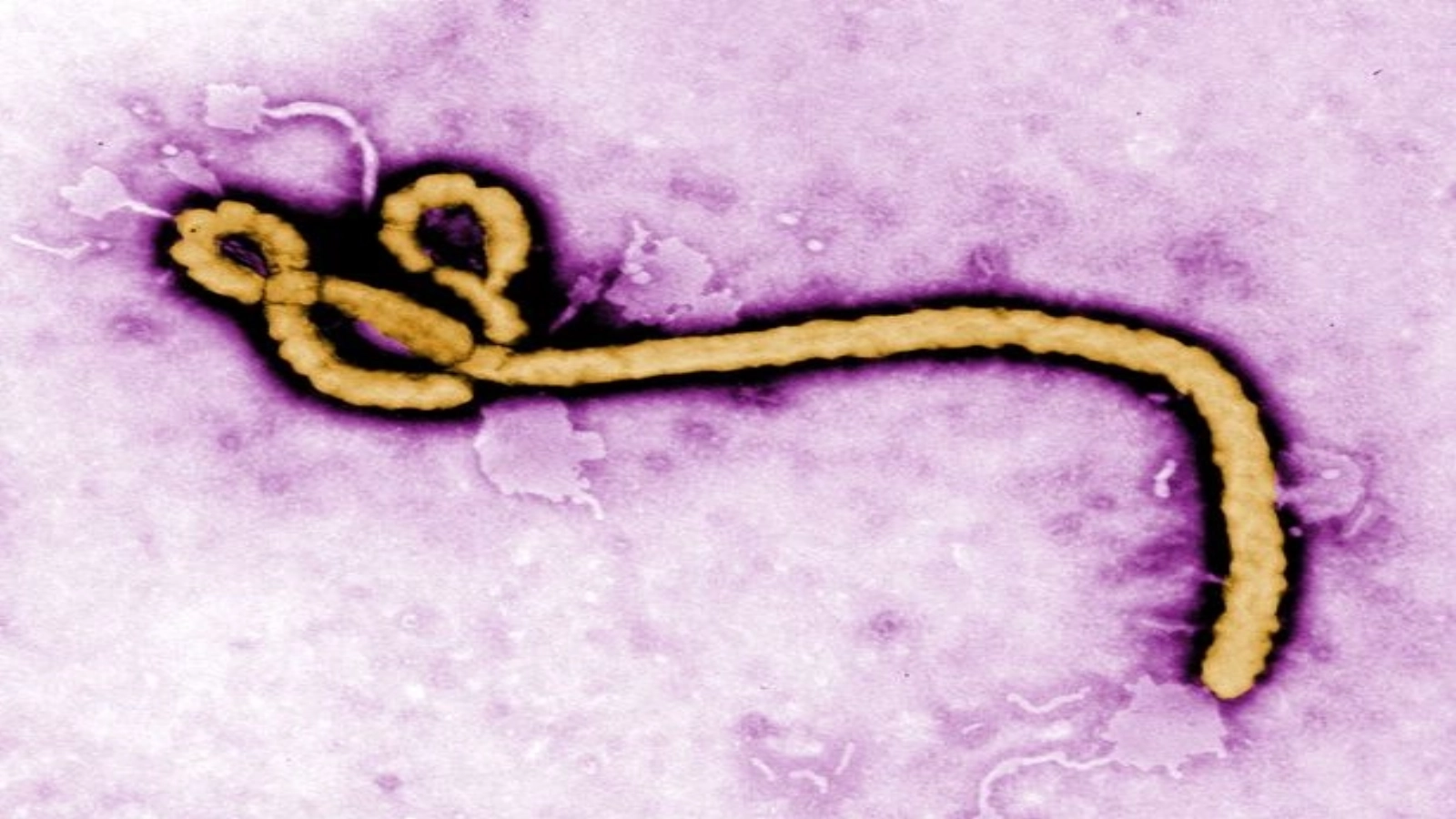 OMS scade drastic numărul cazurilor suspecte de ebola