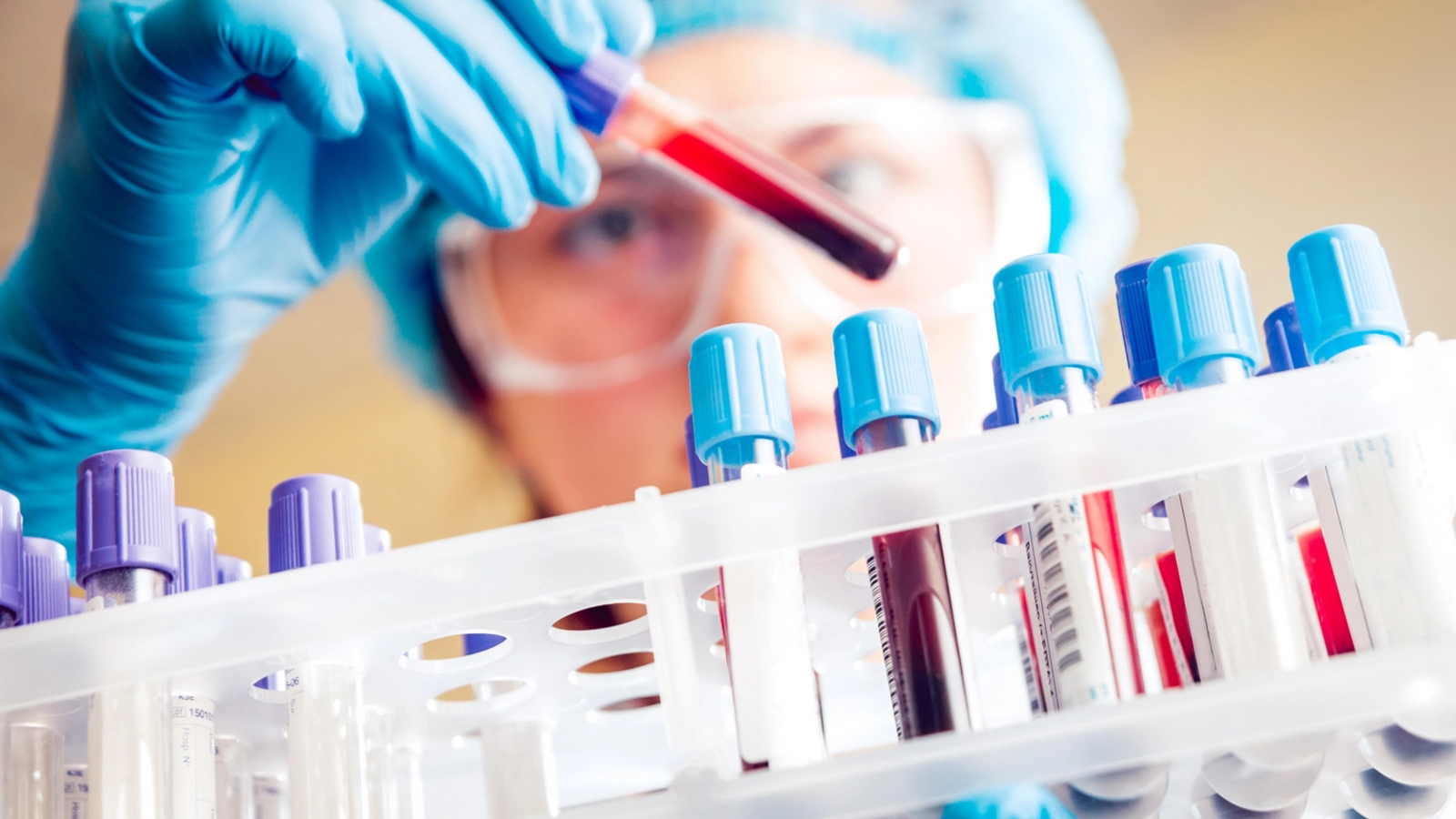 SUA: Testele de sânge sunt acum incluse în recomandările de screening pentru cancerul colorectal