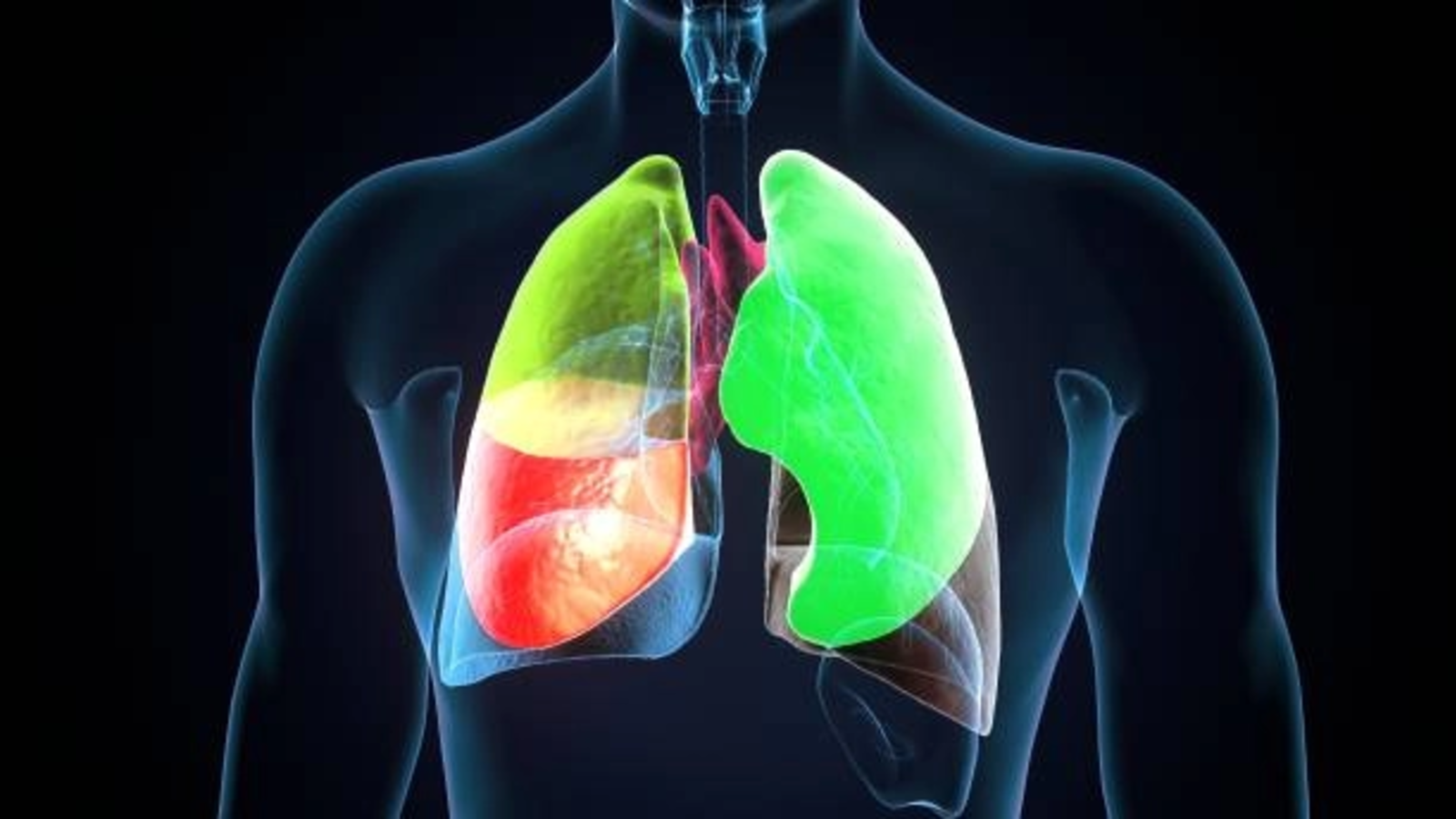 Aproximativ 25% dintre sătenii testaţi gratuit în Blăjel au primit recomandări pentru investigaţii pulmonare suplimentare